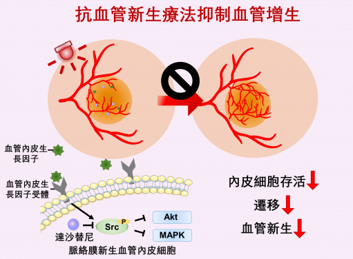 Anti-angiogenic therapy suppresses choroidal neovascularisation (CNV) by inhibiting vascular endothelial growth factor (VEGF)-related pathways. The study represents the first attempt at integrating a photoactivatable anti-angiogenic agent with a photosensitiser into a single nanoformulation for age-related macular degeneration treatment, which opens up new avenues for the development of minimally-invasive therapeutics for AMD and other neovascular ocular disorders.
 